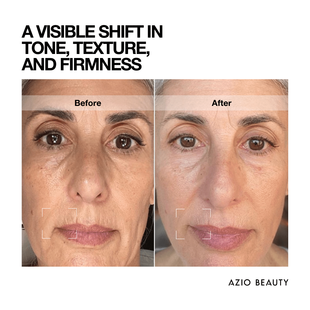 Lift + Plump Duo - Azio Beauty